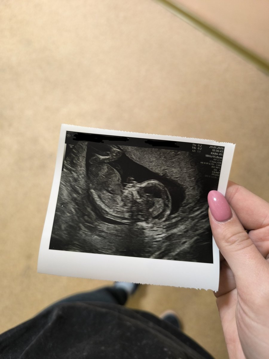 голубой ёж tweet media