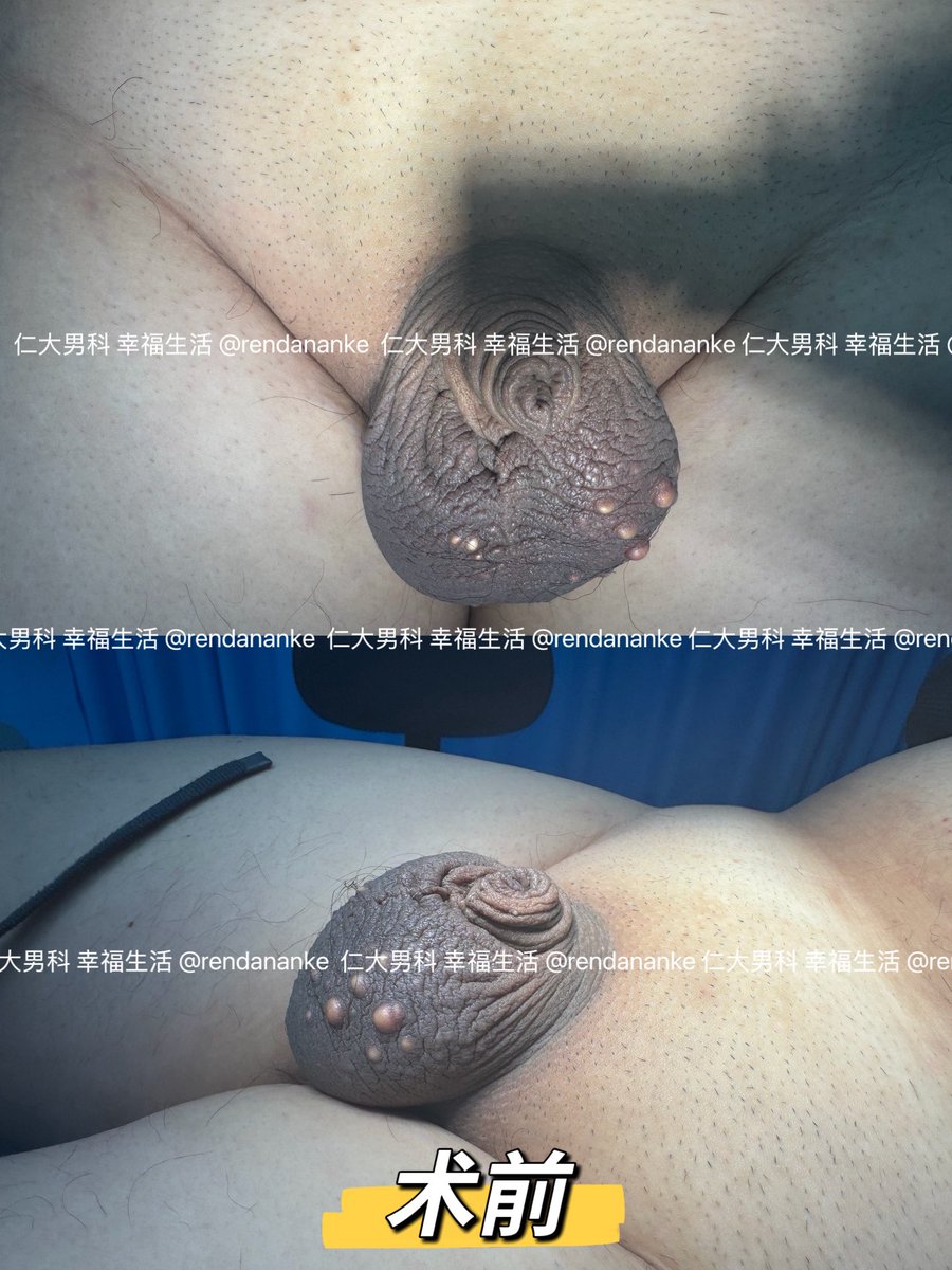 仁大医院男性私密整形 tweet media