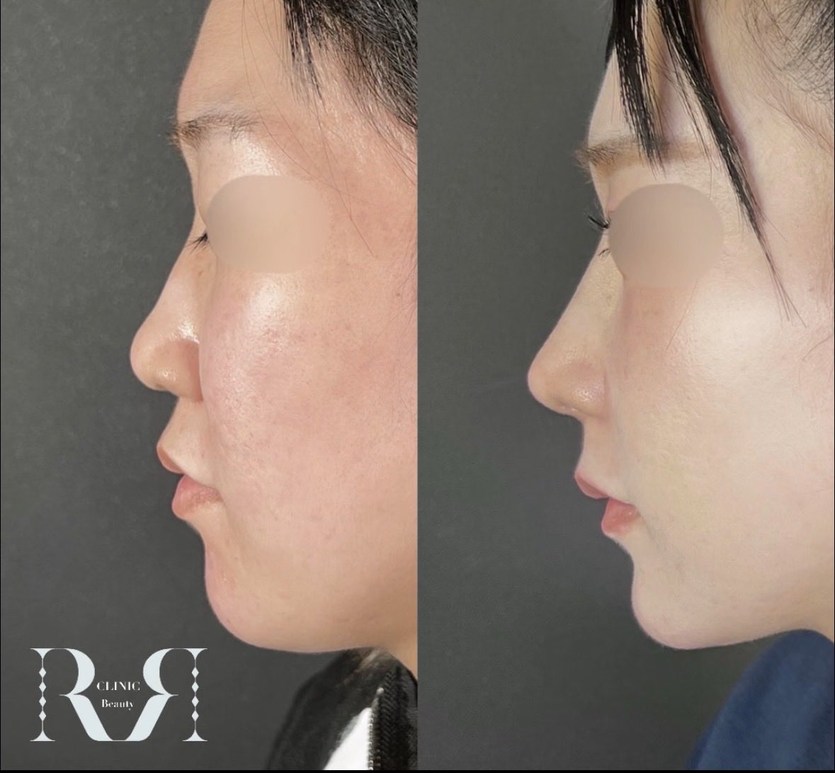 忘れ鼻の美容外科医 Dr小池 tweet media