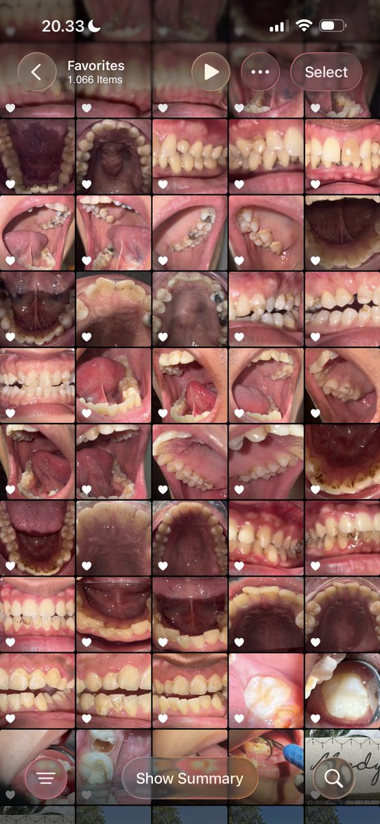 percaya gak percaya, gue hapal ini semua gigi siapa aja🤣🤣🤣