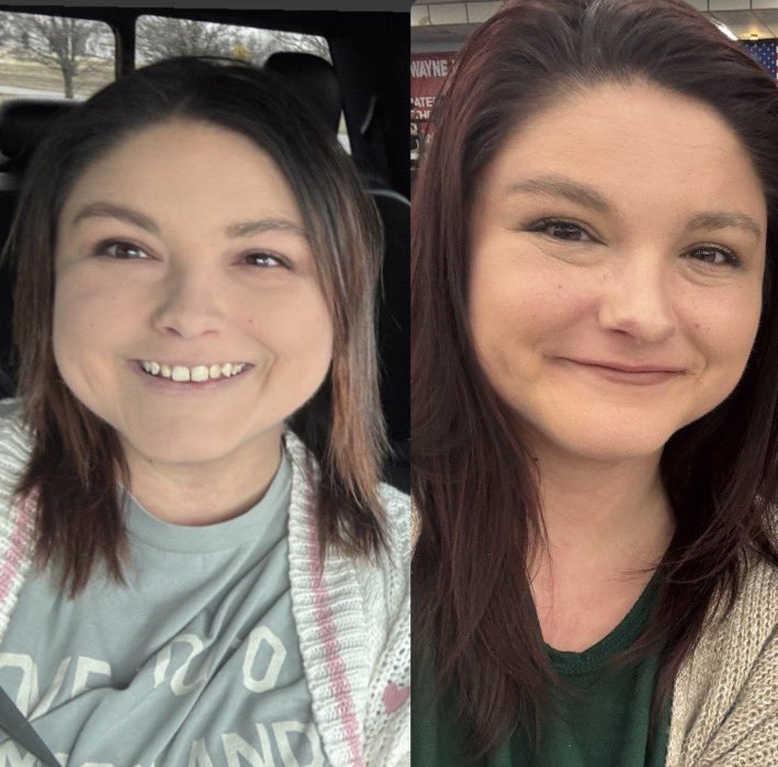 Fun fact: my pain condition, CRPS, makes your hair and nails grow faster than normal. I guess that’s one good thing lol