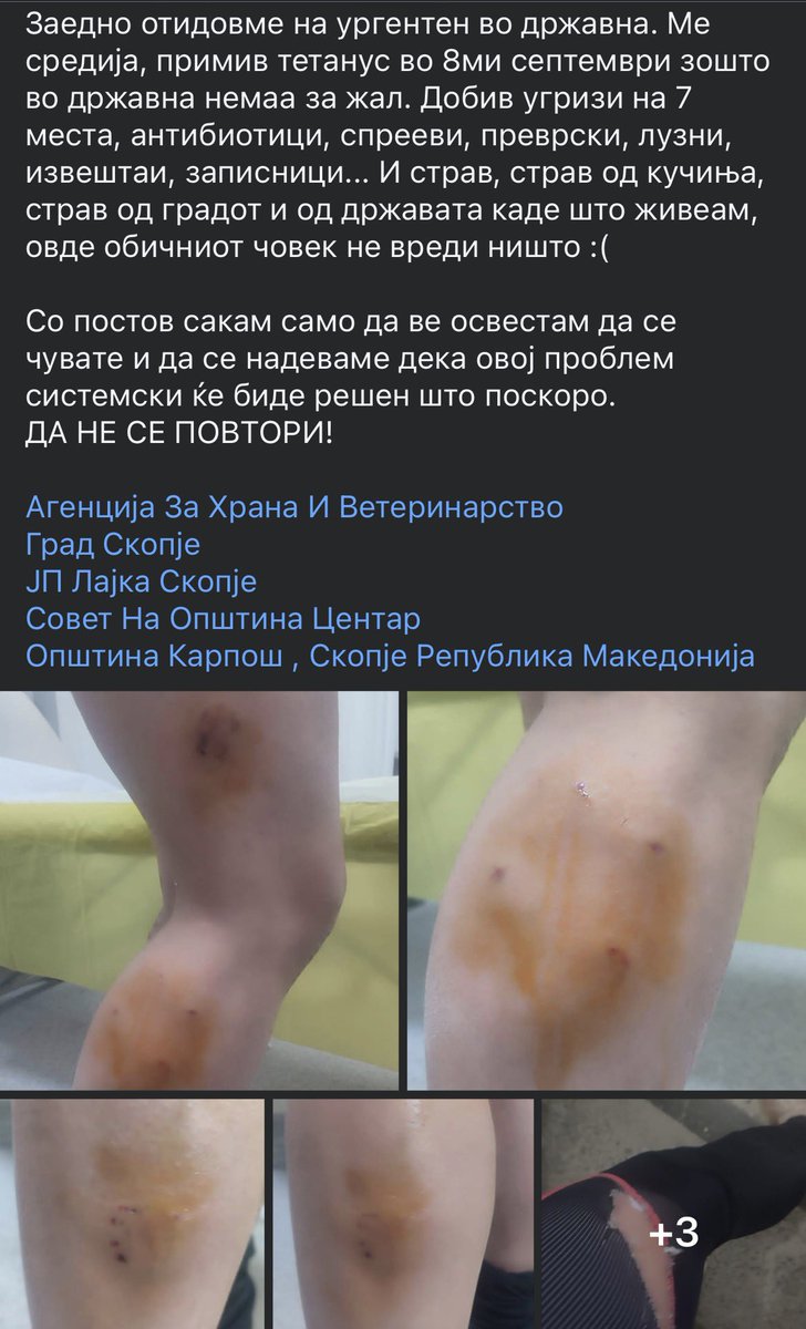 Жена искасана од глутница од десетина кучиња на кеј. Како и во други случаи до сега, на државна немало терапија против тетанус. Траума за цел живот.
И ова е сосема нормализирано. Ќе го прочитаат куѓе, ќе кажат "ц ц ц" и ништо нема да се смени.