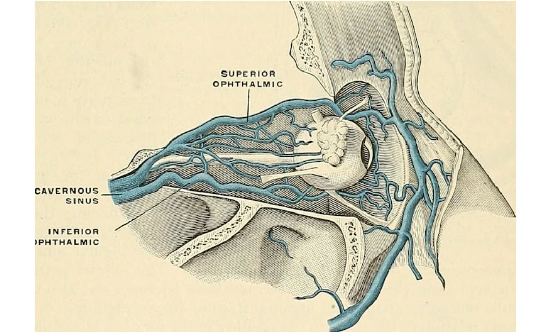 Idie64's tweet image. 삼각형 안에 있는 여드름 짜면 눈 멀 수가 있대..
찾아보니 진짜임;;
손으로 여드름 짜서 저기 지나는 혈관에 세균 감염돼면 눈까지 흘러간다고 함