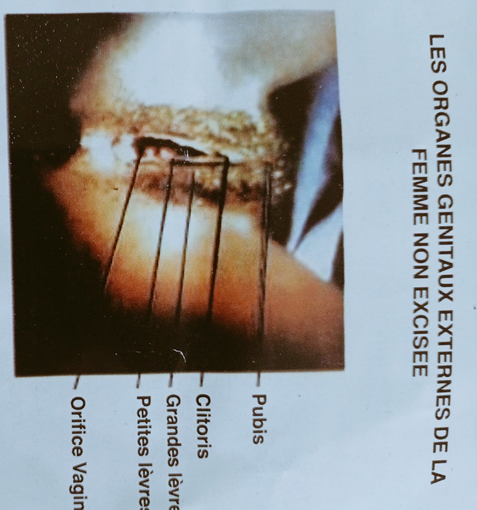 Frédéric Goré-Bi tweet media