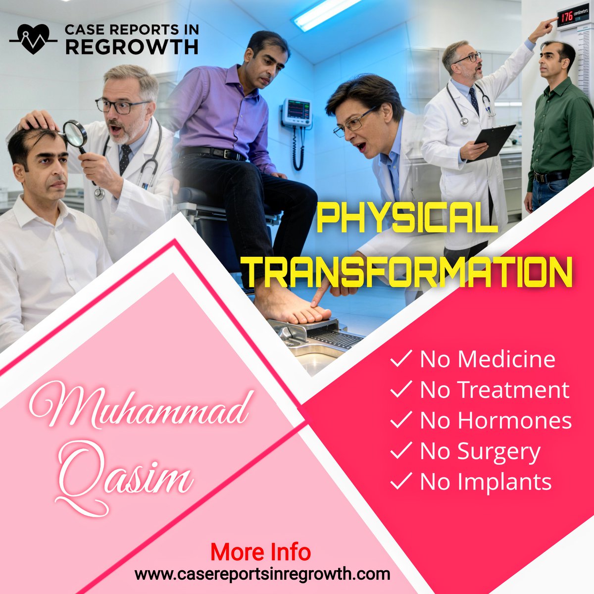 Muhammad Qasim who gre his Height once again 2.7cm in last 13 months.
Also many hair follicles. How foot shoes size also changed twice this year.