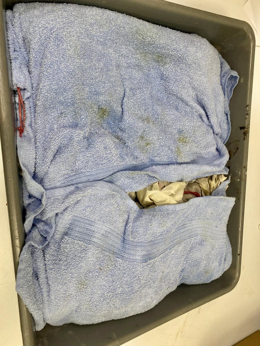 🚫 Tıbbi sülüklerin yasa dışı olarak ülkeye girişi engellendi. 

✈️ İstanbul Havalimanı’nda, 7 Şubat 2026 tarihinde <a href="/isttarimorman/">İstanbul İl Tarım ve Orman Müdürlüğü</a> su ürünleri kontrol görevlilerince gerçekleştirilen denetimlerde, yolcuya ait bir valiz içerisinde kaçak yollarla ülkemize sokulmak istenen yaklaşık