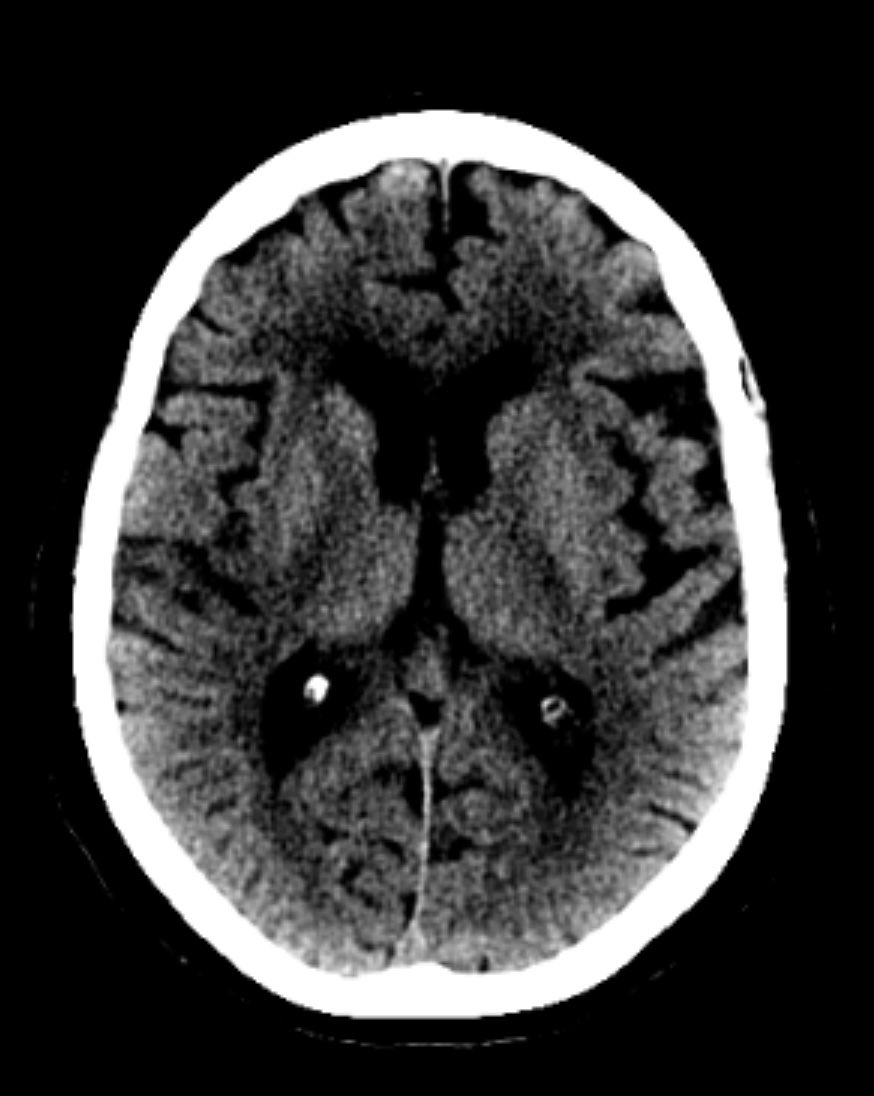 Andrea Zini tweet media