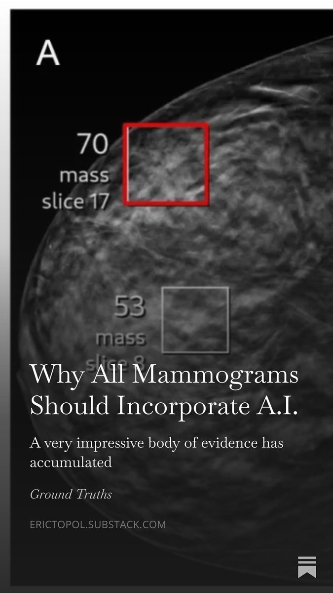 A review of the new trial results (below) along with all the other evidence and conclude it's time to move to AI-support for all mammography (with no cost to patients) erictopol.substack.com/p/why-all-mamm…