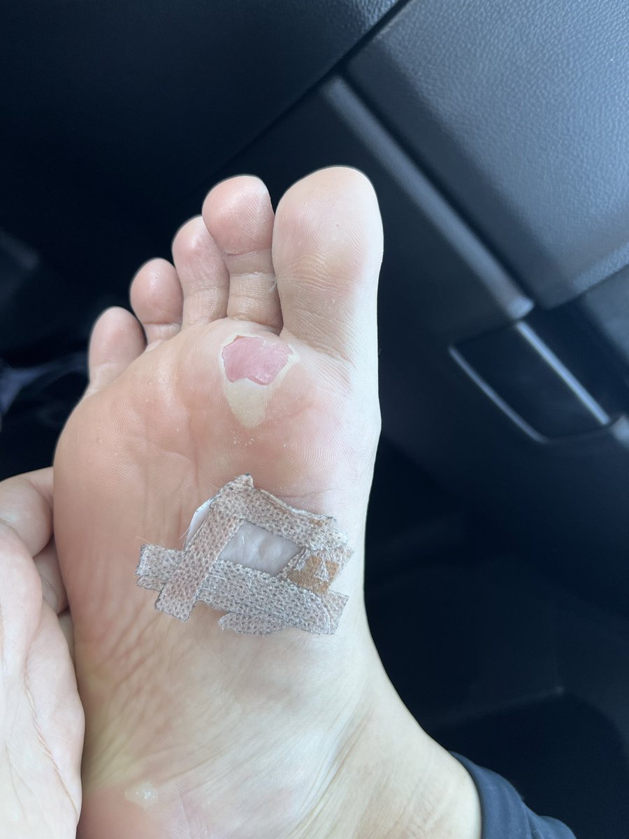ItsASickness's tweet photo. First of many✨ went into the race with fckn blisters &amp; still pushed through!!!! https://t.co/3slRdc4fQ1
