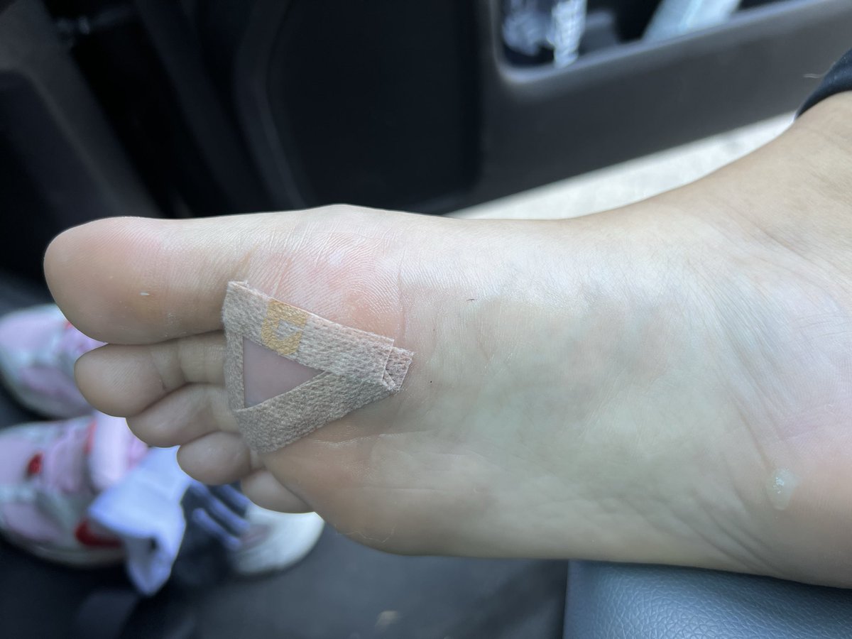ItsASickness's tweet photo. First of many✨ went into the race with fckn blisters &amp; still pushed through!!!! https://t.co/3slRdc4fQ1