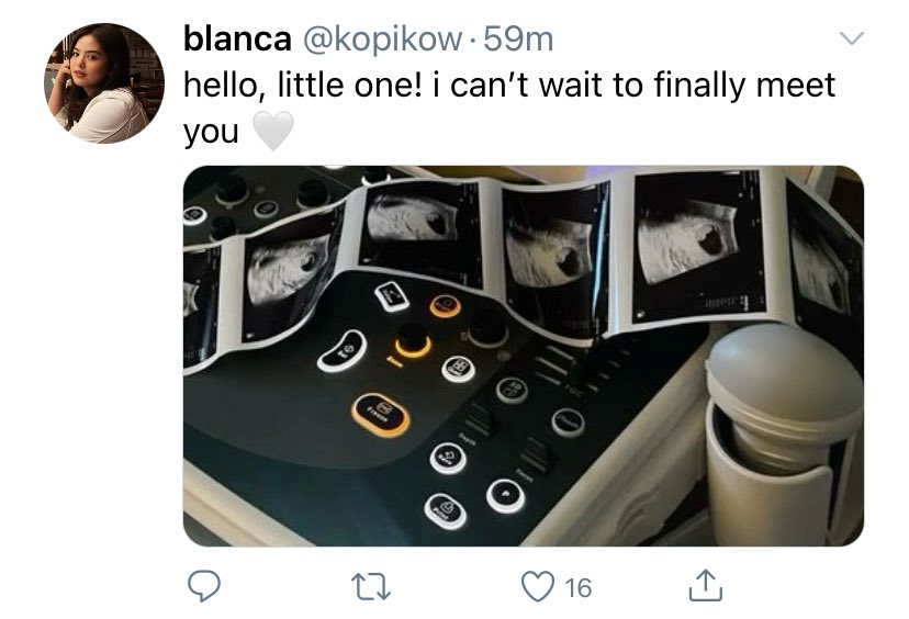 wilbewishin's tweet image. IN THE AFTERMATH : a #wilbea au

after splitting up with Wate Malatteo (w) last month, Blaine Cattiana / Blanca (b) later discovers that she is pregnant.