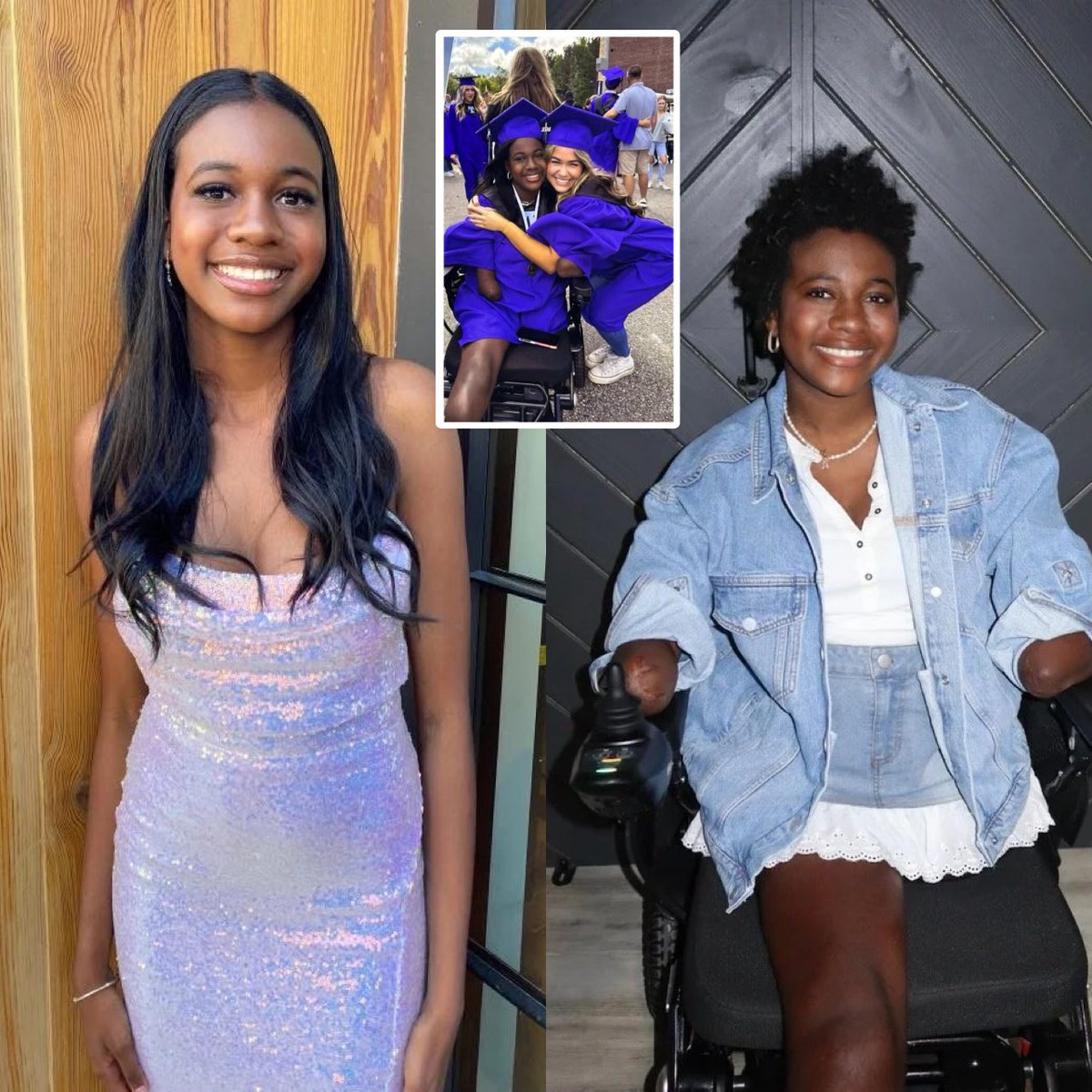 17-year-old Natalya ‘Nat’ Manhertz had to have both arms and legs amputated after a severe strep throat infection. Placed in a coma and in the hospital for 6 months, she still graduated top of her class, won prom queen despite the hardship and recovery. Her family says, ‘Her
