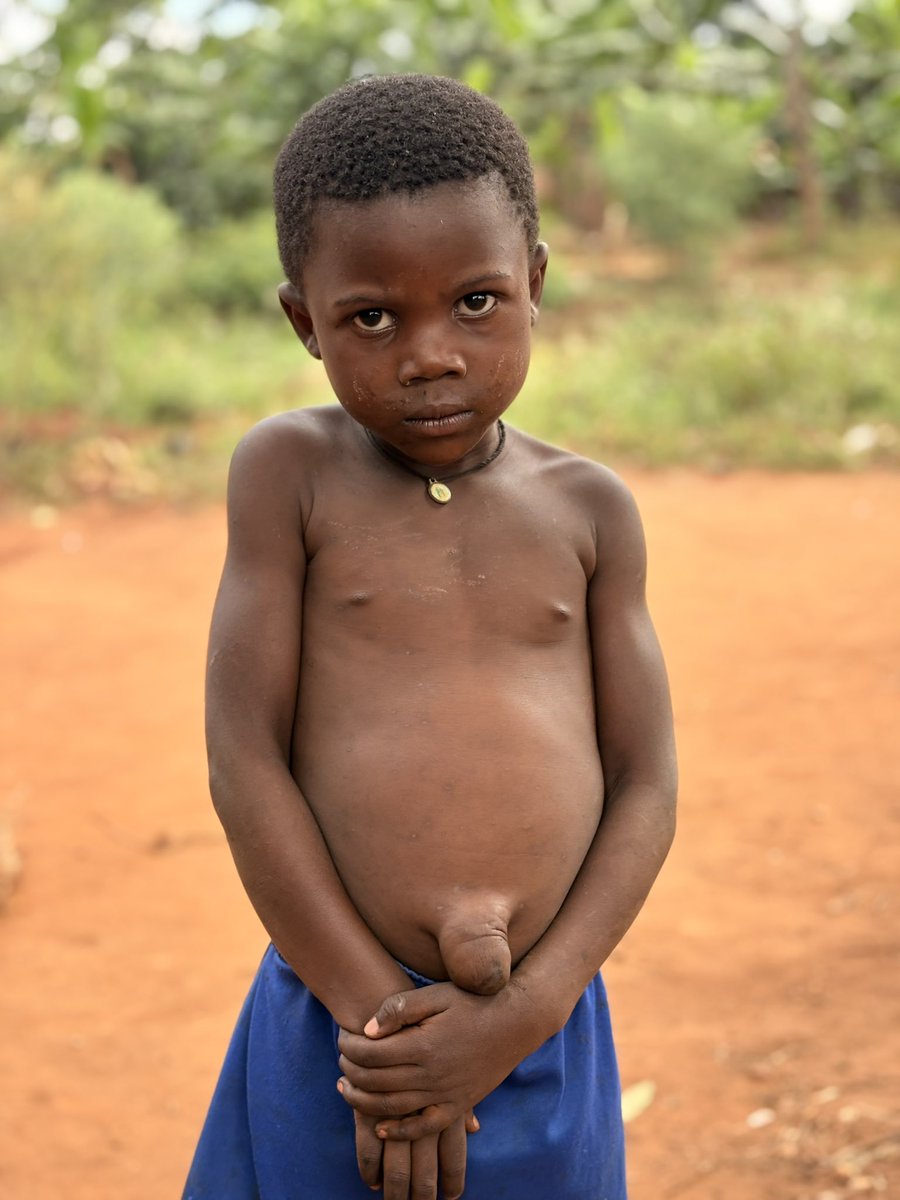 Resty has an umbilical hernia and needs surgery. Your prayers and support mean everything to us 🙏