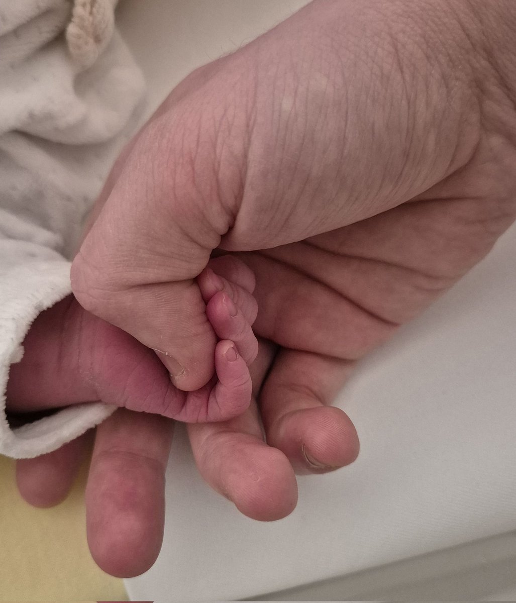 Alir 🇨🇭 tweet media