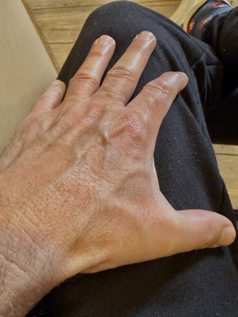 venas marcadas
¿Te gustan o no?