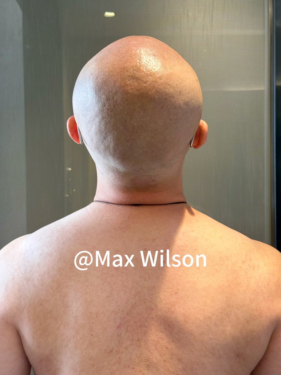Max tweet media