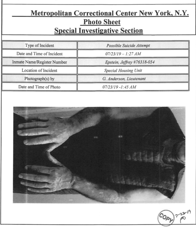 _Akanamy_'s tweet photo. + didn't he have a tattoo? #EpsteinFiles https://t.co/toXGQ9DLiG