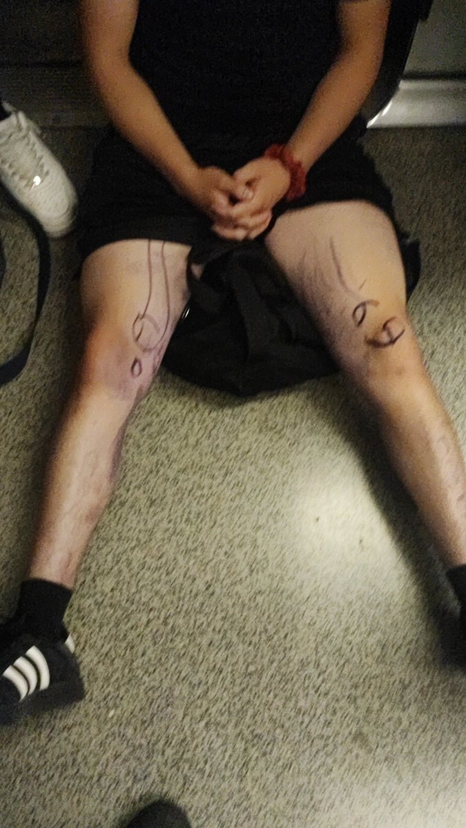 alwnsooocho tweet media