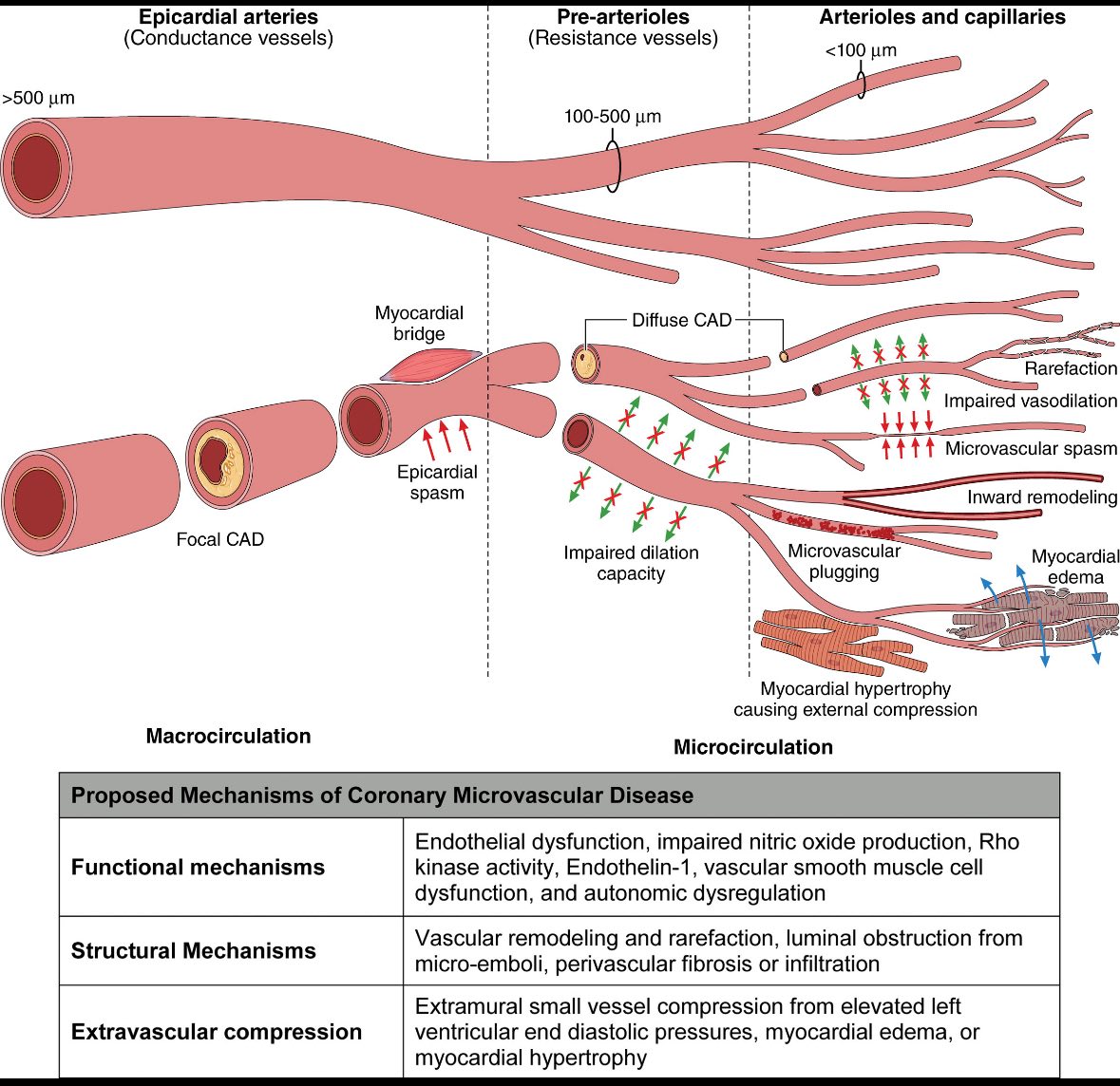 INOCA_belgium's tweet photo. #ANOCA #INOCA #MINOCA #NOCAD 🫀
#Endotypes
#CAS #VSA #CMD #MVA ❤️🩹
#EndothelialDysfunction #MyocardialBridging
#MixedEndotypes
2/2 https://t.co/Yd2xPPf6v4