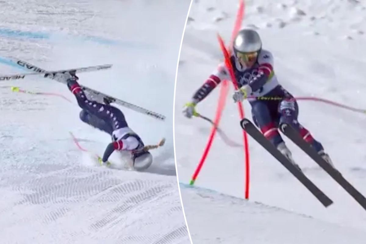 Lindsey Vonn has surgery for leg fracture after devastating Olympics crash nypost.com/2026/02/08/spo…