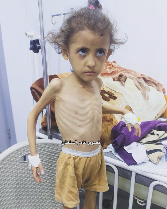 Zaragull22's tweet photo. Humanity check ✔️ 💔
If you see this little angel, reply with 🇵🇸 💔 https://t.co/ARsbWmCAZn