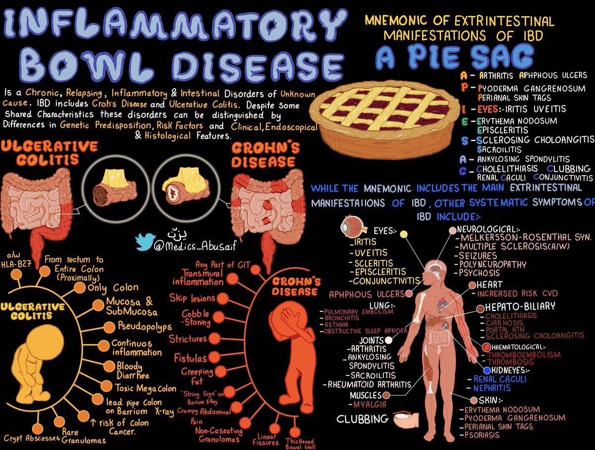 Inflammatory bowel disease (IBD) overview 🌟

Credit: <a href="/medics_AbuSaif/">يـزّن الغماس</a>