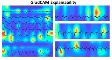 Sandeep Gautam tweet media