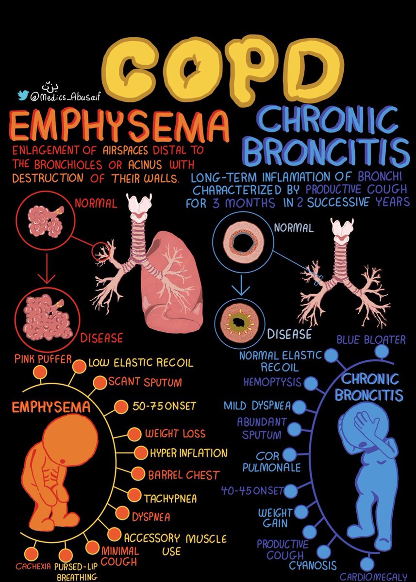 COPD Overview 🌟

Credit: <a href="/medics_AbuSaif/">يـزّن الغماس</a>
