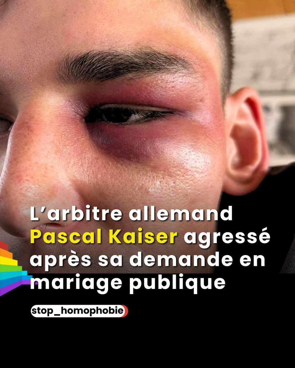 🟥 L’arbitre allemand Pascal Kaiser, 27 ans, a été agressé à son domicile dans la nuit du 7 février, après avoir fait sa demande en mariage à son compagnon Moritz devant 50 000 spectateurs lors d’un match de Bundesliga à Cologne.

Suite à la diffusion de la vidéo, il a reçu de