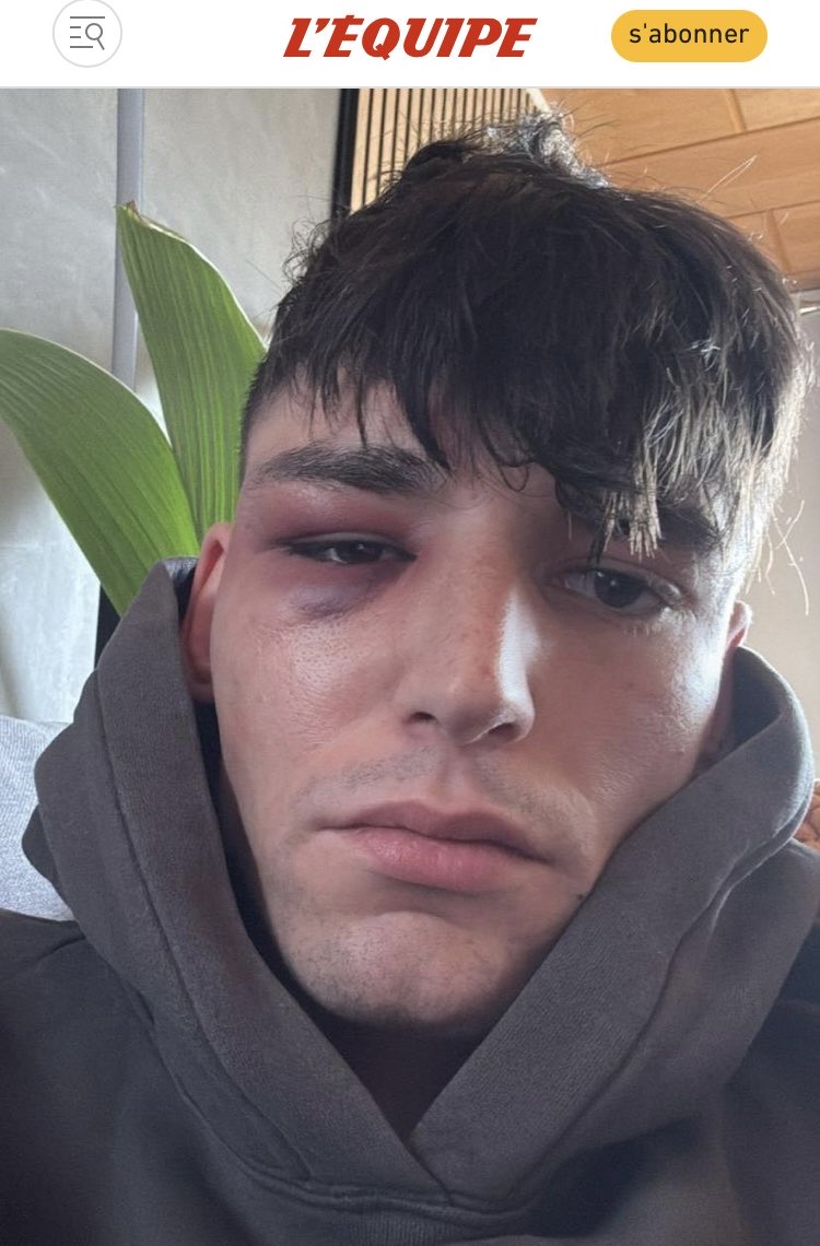 Léopold 💸 tweet media