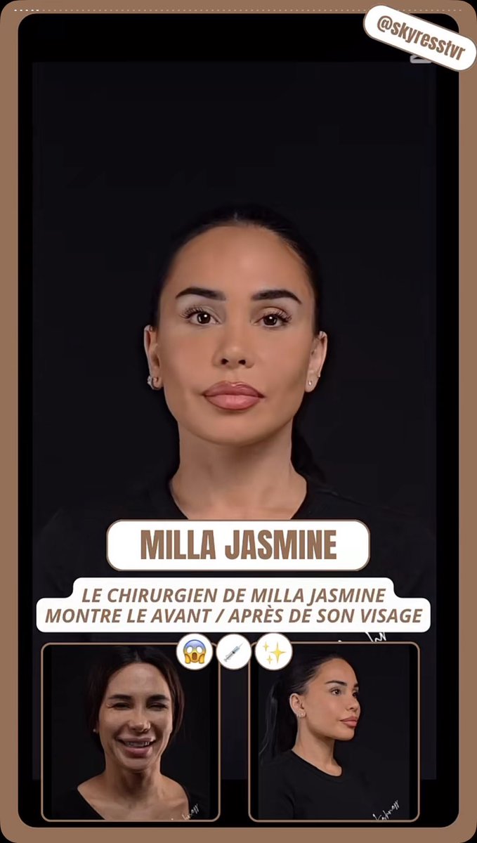 𝓜𝓮𝓵𝓪 🌙🏴‍☠️ tweet media