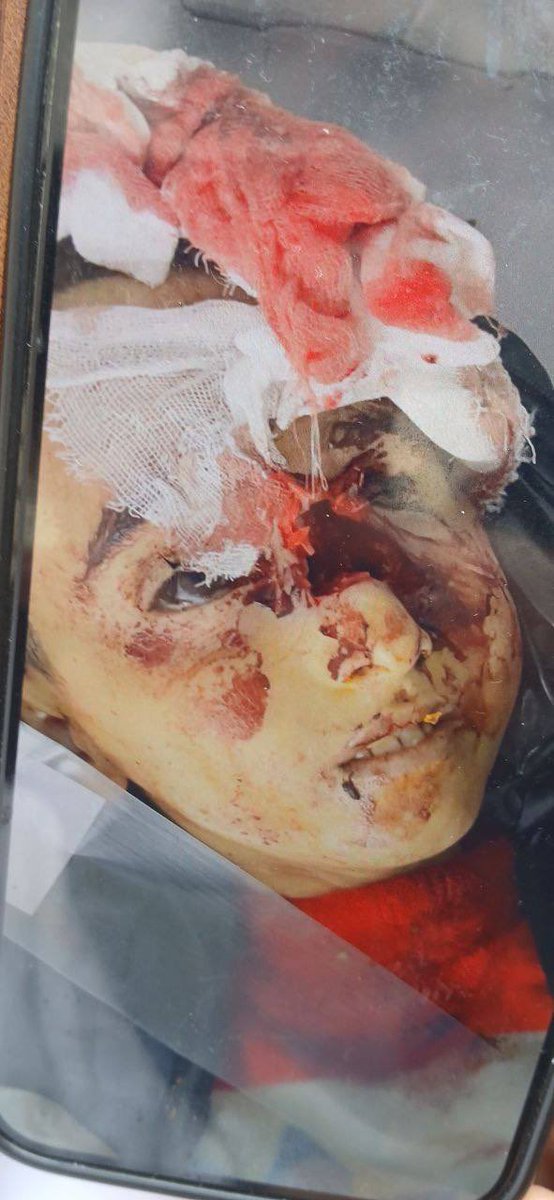 This is how Islamists send our children home. Meanwhile, you’re negotiating.
#TahaHooshyar