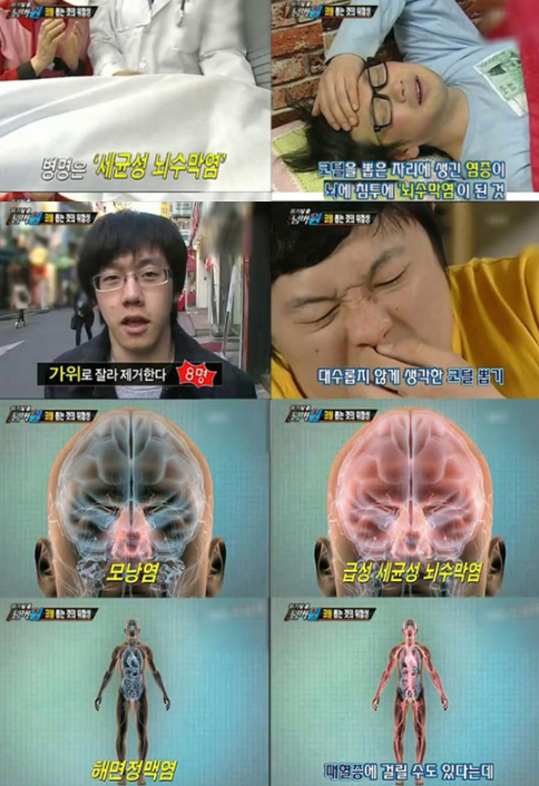 dermtae's tweet image. 코털 뽑다 사망한 위기탈출 넘버원이 생각나는 글.

실제로는 매우 낮은 확률이겠지만, 경각심을 갖는건 좋겠죠?!

저 삼각형 안에 있는 정맥(vein)에는 
혈류가 한쪽으로 흐르도록 하는 판막(밸브)의 기능이 약해서,
눈을 지나 뇌(해면정맥동)까지도 혈류가 진행할 수 있습니다. 

따라서 코주변…