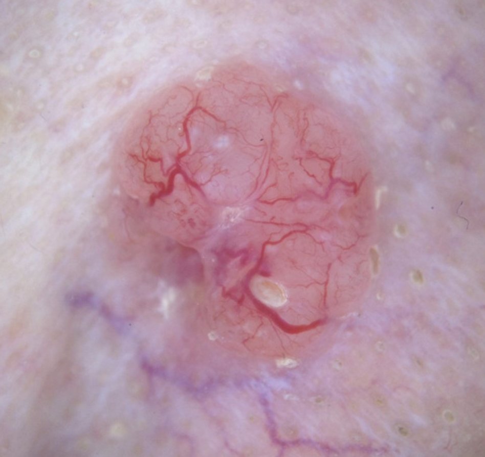 Marianne Signoret tweet media