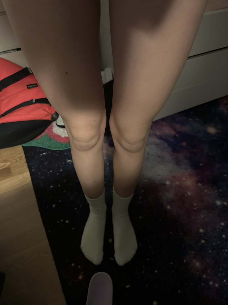 Isaamira5's tweet image. Thigh gap?