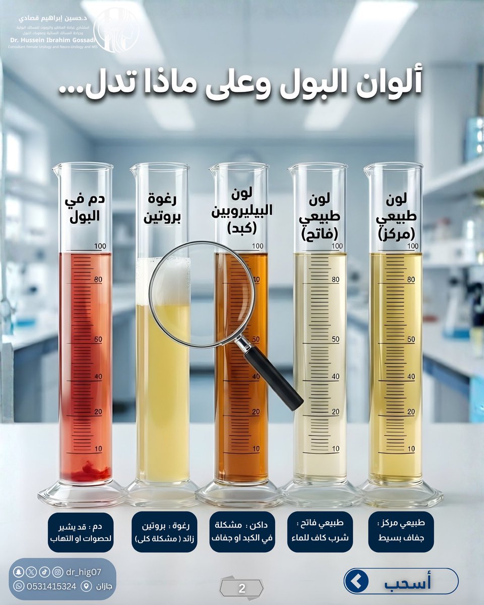 DR_HIG07's tweet photo. جسمك يرسل لك "رسالة" كل صباح.. هل قرأتها؟ 📩
راقب لونك اليوم، وصحح مسارك بشرب الماء أو زيارة الطبيب.
📍 عيادة د. حسين قصادي
جازان
#ألوان_البول #صحتك_في_لونك #شرب_الماء #حصوات_الكلى #التهاب_البول #زلال_البول #صحة_الكلى #جازان #معلومة_طبية #دكتور_حسين_قصادي #UrineColor #Hydration https://t.co/s2sPQHl8zH