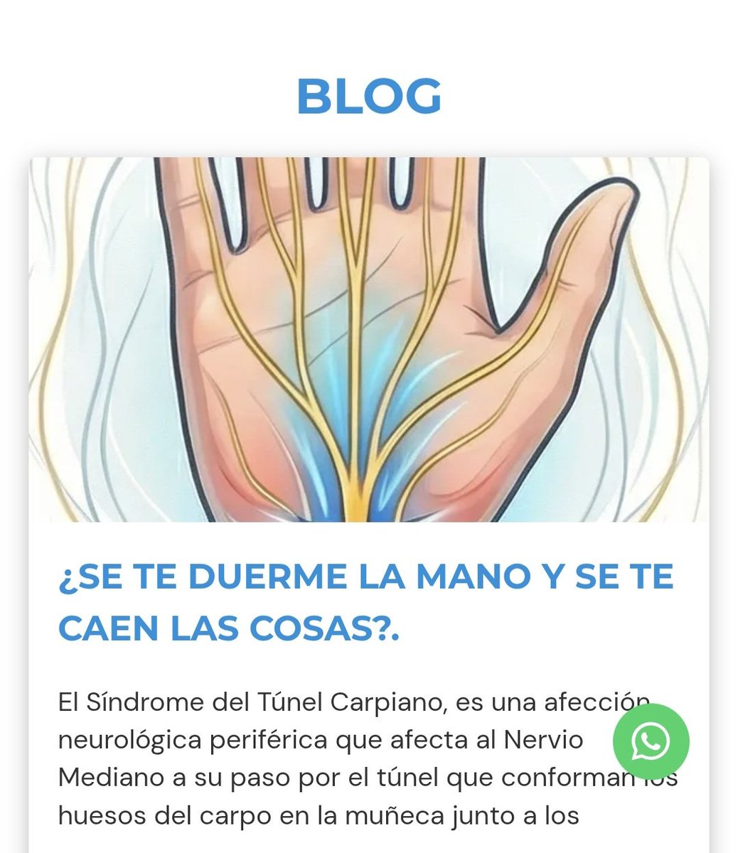 El Síndrome del Túnel Carpiano, es una afección neurológica periférica que afecta al Nervio Mediano a su paso por el túnel que conforman los huesos del carpo en la muñeca junto a los tendones flexores de los dedos.
fisiomechanics.es/se-te-duerme-l…
