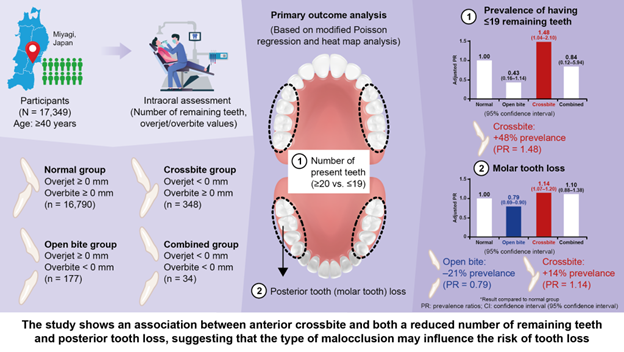 TohokuMedMbank's tweet photo. Underbite Is Associated With Tooth Loss Risk [Press Release]
https://t.co/W50OLvcHkN
#anteriorcrossbite
#crossbite
#openbite https://t.co/2UtqTKF8UO