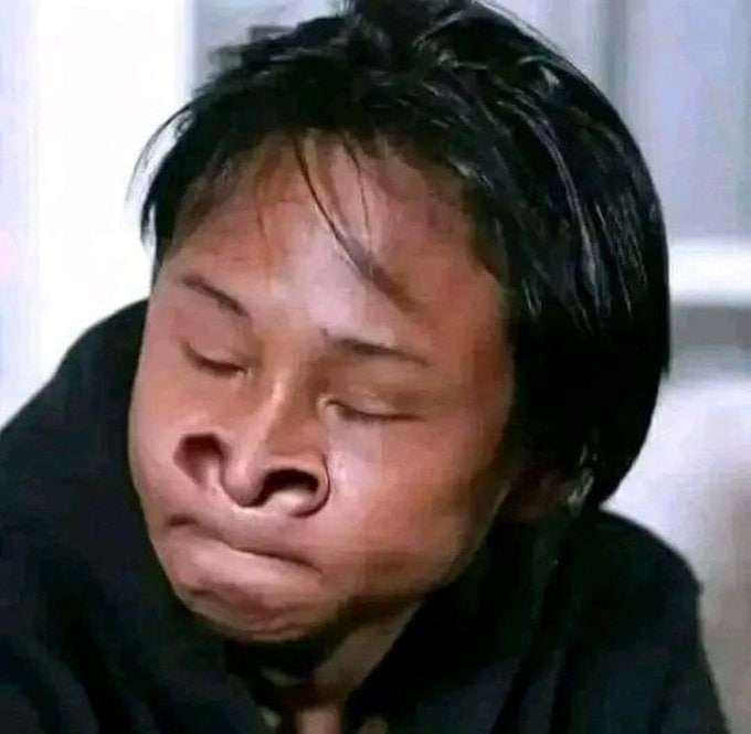 yepzXBT 🇮🇩 tweet media