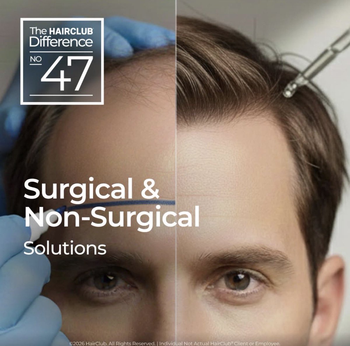 michaeledonner's tweet photo. HairClub provides a full range of surgical and non-surgical #HairLoss solutions—from #HairGrowthProducts and custom #HairSystems to #HairTransplant options like #FUE and #FUT. Discover your best #HairRestoration plan with a free consult. 

Book today - https://t.co/AG2uEFYkRo https://t.co/HDoaxe7NUY
