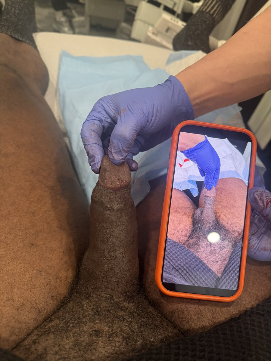 Dr. Jason Emer tweet media