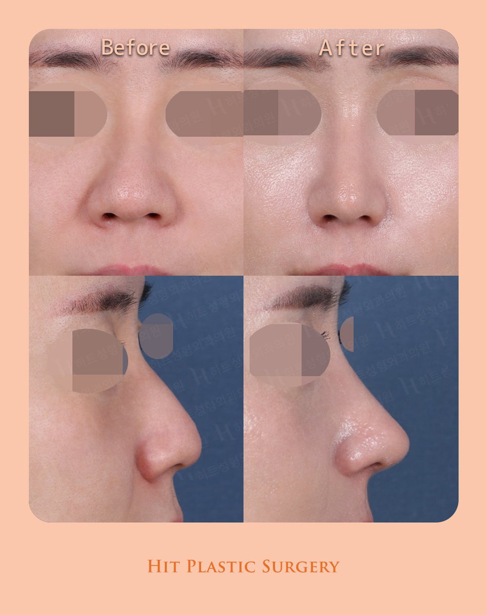 ヒット整形外科 tweet media