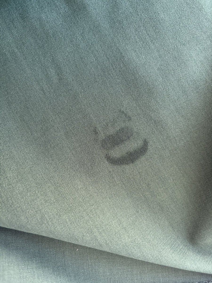 0歳娘につけられたキスマーク