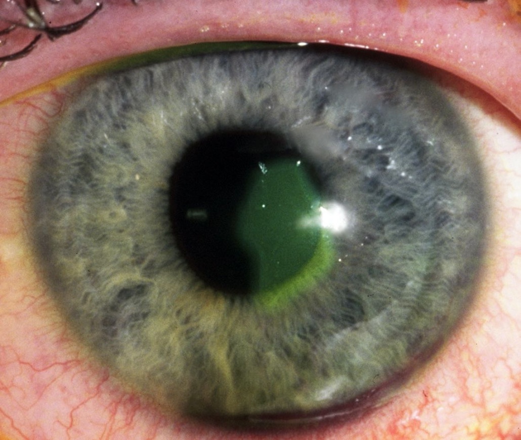 Dr Gunjan Deshpande MRCSEd, FICO (UK), FAICO, DNB tweet media