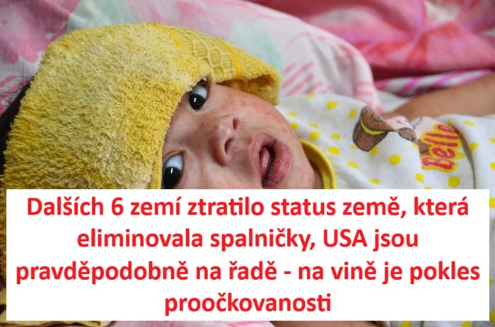 Británie a několik dalších evropských zemí ztratily status země, kde byly spalničky eliminovány, uvedla Světová zdravotnická organizace po prudkém nárůstu infekcí na celém kontinentu.
tinyurl.com/2a9mo4p5