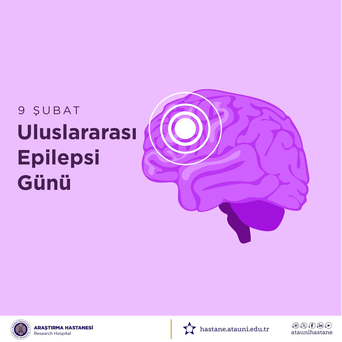 Epilepsi, beyin kaynaklı nöbetlerle seyreden ve doğru tedaviyle kontrol altına alınabilen bir hastalıktır. Bilgi, anlayış ve doğru müdahale; yaşam kalitesini artırır.

<a href="/atauni1957/">Atatürk Üniversitesi</a>

#Epilepsi
#DoğruBilgi
#Farkındalık