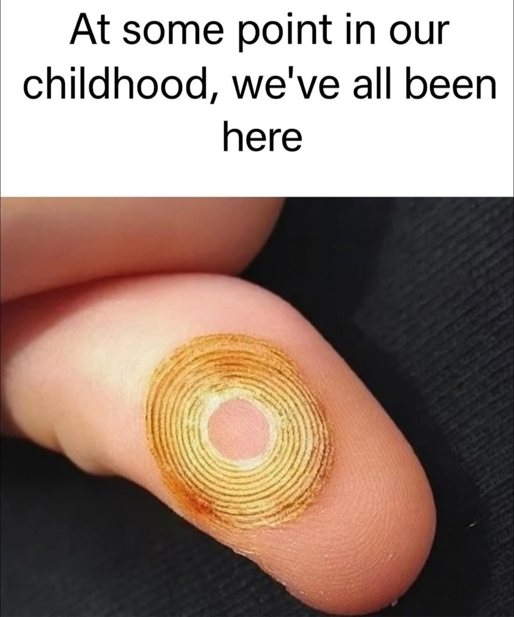 bagshaw2112's tweet image. Today’s Memory jogger . I bet  most of us have done this and have the pain to make us not do it again (and the smell of burning flesh) . #ouch #memory #monday