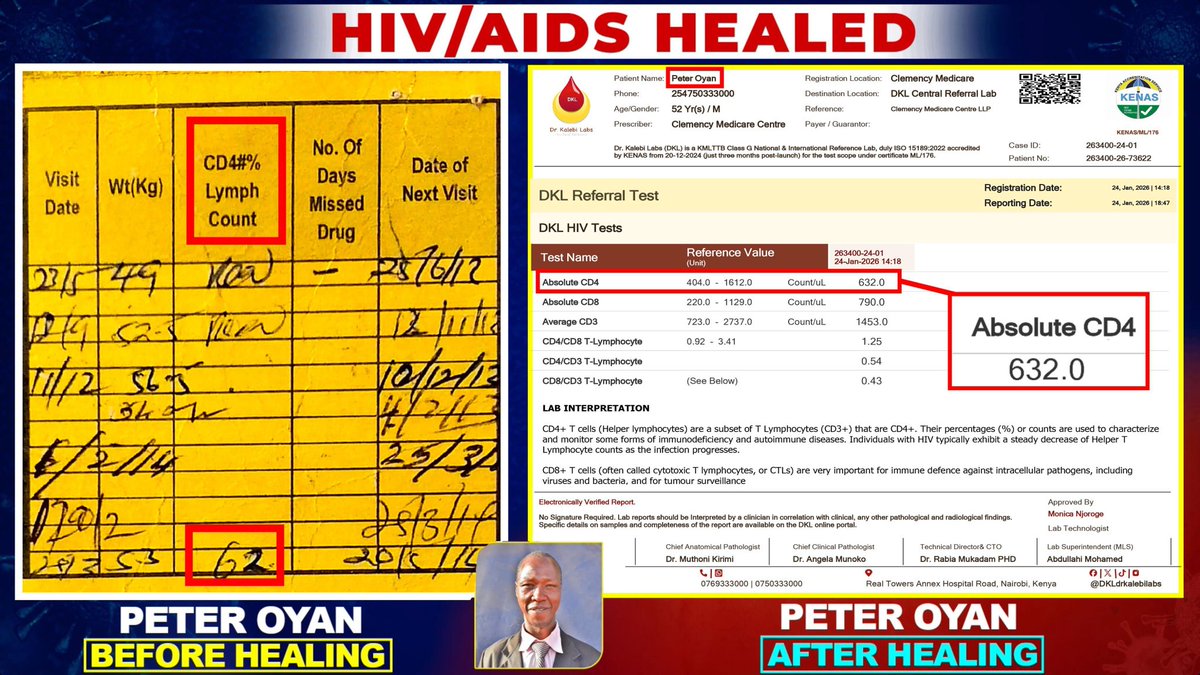 KemuntoLish's tweet photo. @TTemesi80614 Thank you Dr. Tommy.

We have four pillars of medical ethics:
 • Autonomy
• Beneficence
• Non-maleficence
• Justice
 Continuing ARVs in an HIV-negative patient violates at least three.
This is not controversial medicine. It is basic ethics.

#BloodOfJesusHealsHIV https://t.co/iSBCKdVmnJ