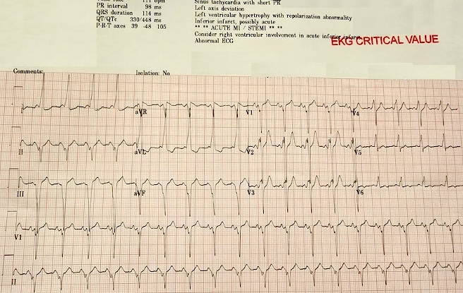 ECGWeekly tweet media