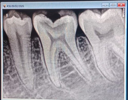 The statistics are not just numbers. They’re symptoms of a silent emergency unfolding in our homes.

🚨 50% of Indian children are overweight or obese.
📱 59% spend recreation time stuck to screens.
⚽ Only 12% engage in sports, arts, or meaningful activity.
💊 41% are on some
